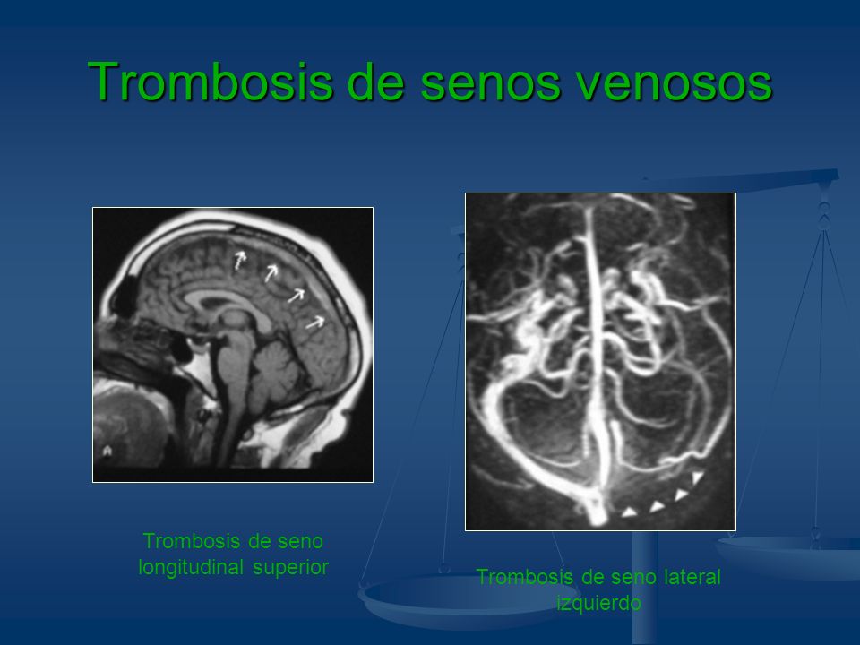 La crema del ungüento y los geles de varikoza